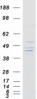 Human KIR2DS3 Protein (Recombinant Myc-DDK (Flag))