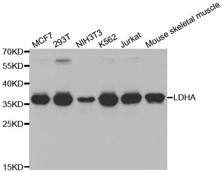 LDHA / LDH1 Antibody