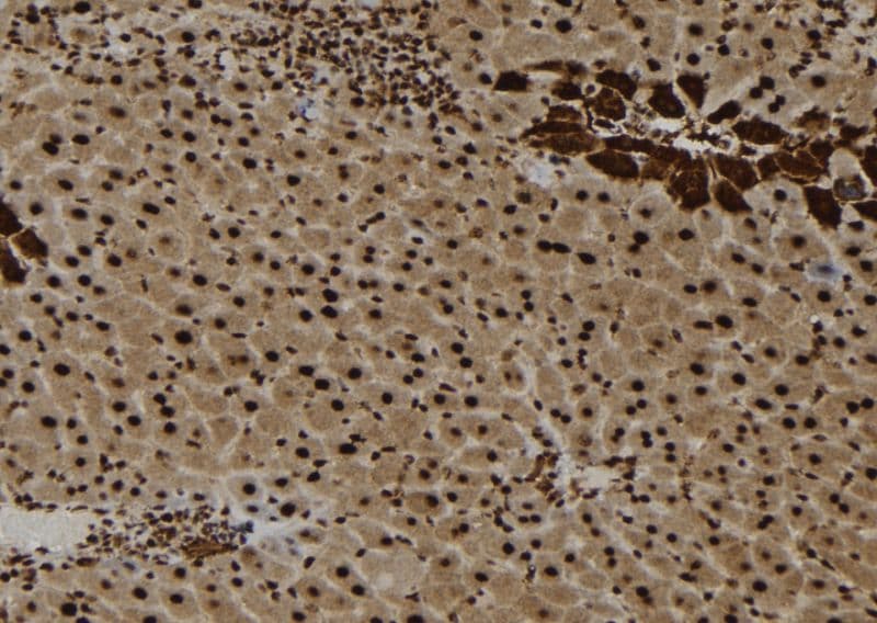 IL16 Antibody