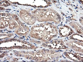 TUBAL3 Antibody (clone OTI4D8)