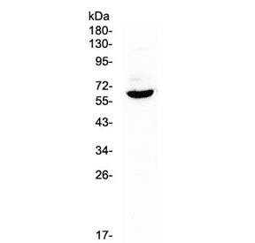 HPSE / Heparanase Antibody