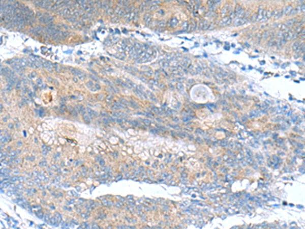 JOSD1 Antibody