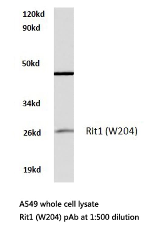 RIT1 Antibody (Trp204)
