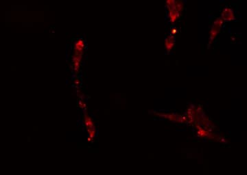 APPL1 / APPL Antibody