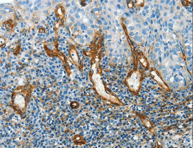 CAV1 / Caveolin 1 Antibody