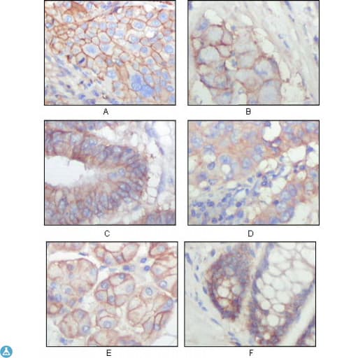 EPHB3 / EPH Receptor B3 Antibody