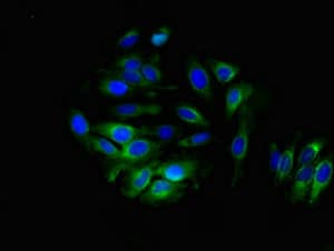 ALDH3B1 Antibody