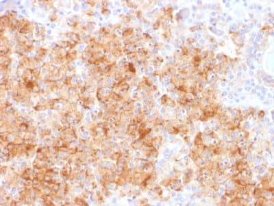 CHGA / Chromogranin A Antibody (clone CHGA/1731R, Azide-free, Carrier-free)