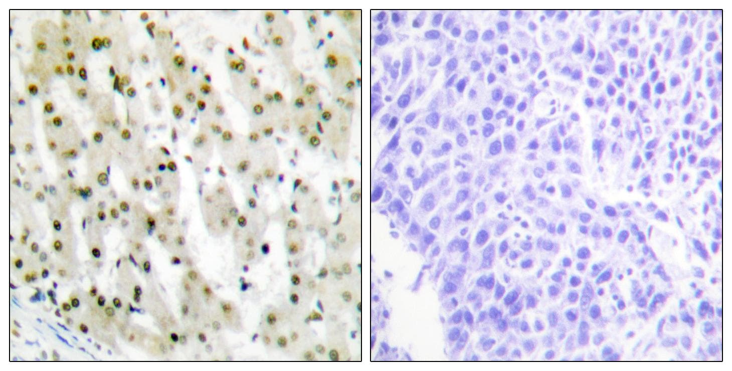 HNRPA1 / HnRNP A1 Antibody