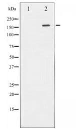Polyclonal Rabbit anti-Human ROCK2 Antibody (WB)