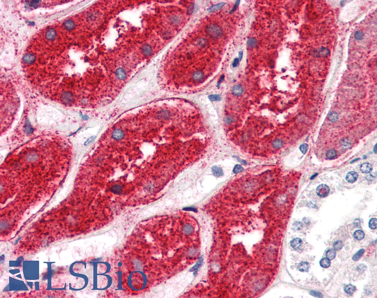 IHC-plus™ Polyclonal Rabbit anti-Human Renal Dipeptidase / DPEP1 Antibody (N-Terminus, IHC)