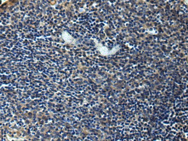 Polyclonal Rabbit anti-Human ERLIN1 / SPFH1 Antibody (IHC)