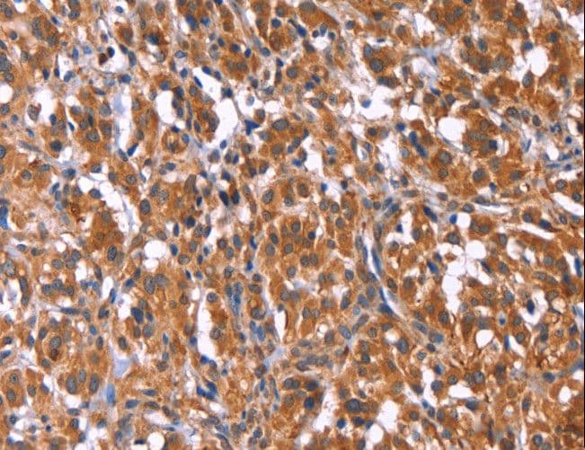 Polyclonal Rabbit anti-Human TDP2 / TTRAP Antibody (IHC)