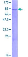 Human MLYCD / MCD Protein (Recombinant GST)