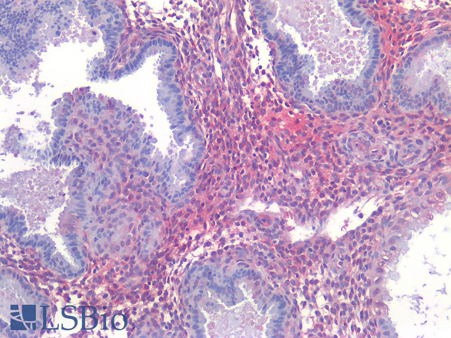 IHC-plus™ AGTR2 / AT2 Receptor Antibody (Internal)