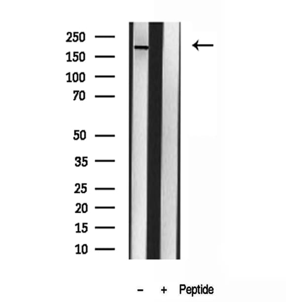 NOT1 / CNOT1 Antibody
