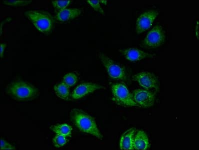 Polyclonal Rabbit anti-Human QDPR / DHPR Antibody