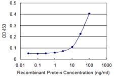 Monoclonal Mouse anti-Human RING1 Antibody (clone 1F4, WB)