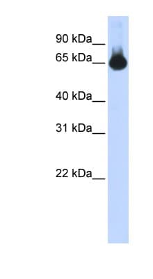 BF1 / FOXG1 Antibody (aa71-120)