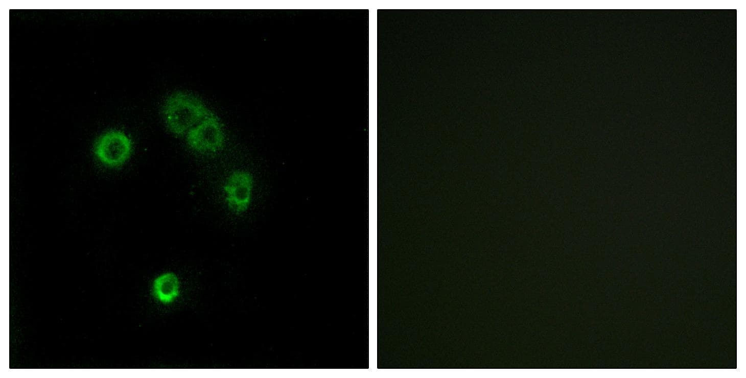 T2R13 / TAS2R13 Antibody