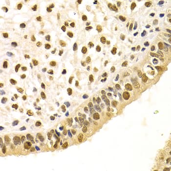 Polyclonal Rabbit anti-Human DDB1 Antibody (IHC, WB)