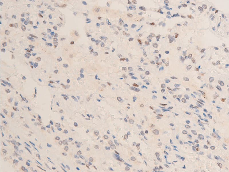 CHEK2 / CHK2 Antibody (phospho-Thr68)