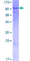 Human EPB42 Protein (Recombinant GST)