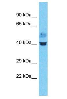 ZNF843 Antibody (aa58-107)
