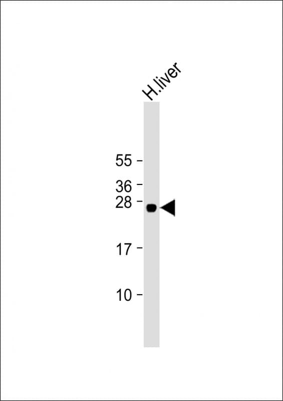 Polyclonal Rabbit anti-Human GSTA5 Antibody (Internal, WB)