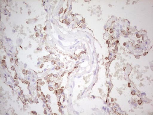 ABCB1 / MDR1 / P Glycoprotein Antibody (aa995-1280, clone OTI11D2, Carrier-free)