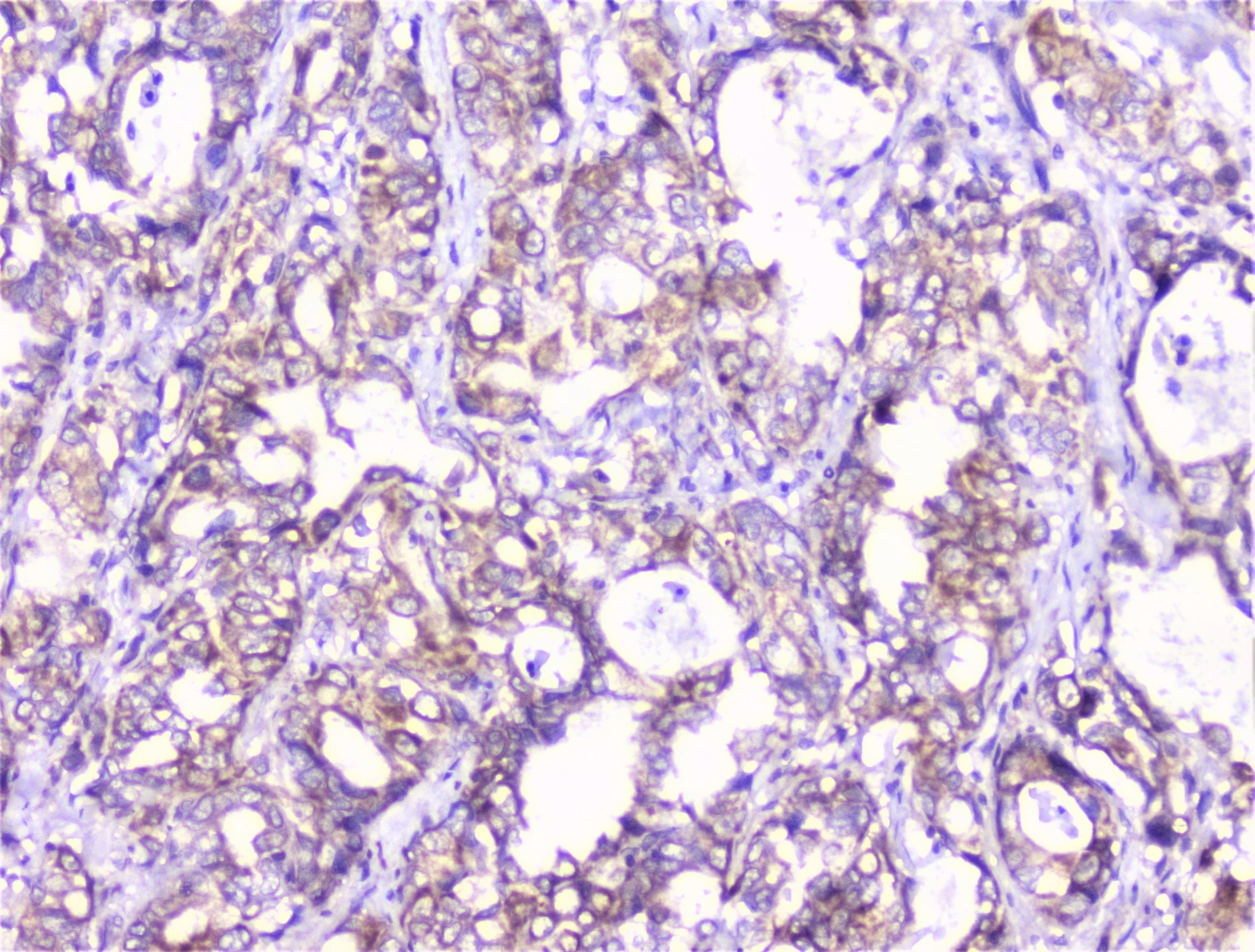 COMP / THBS5 Antibody