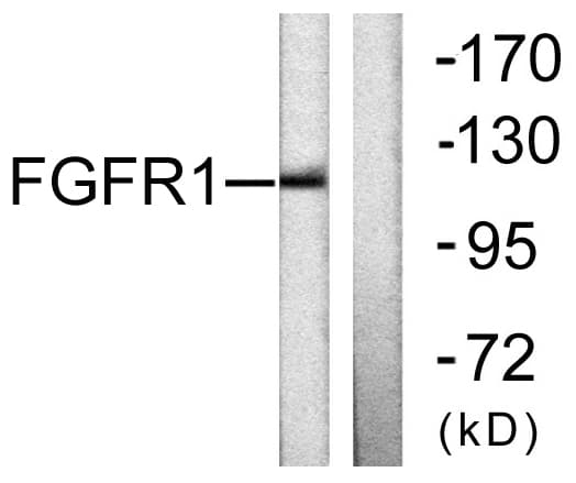 FGFR1 / FGF Receptor 1 Antibody (aa626-675)