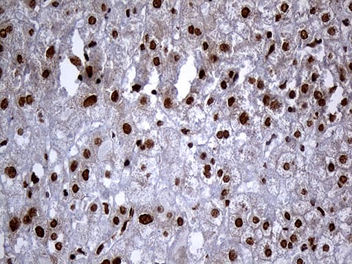RAD21 Antibody (aa193-458, clone OTI2A12)