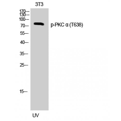 Polyclonal Rabbit anti-Human PRKCA / PKC-Alpha Antibody (580-660 aa, IHC, WB)