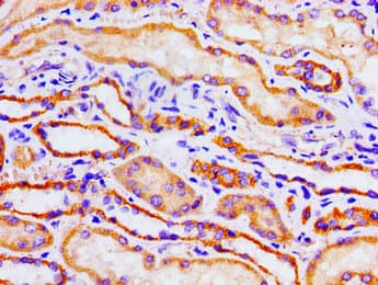 ACO1 / Aconitase Antibody