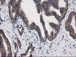 CTNNB1 / Beta Catenin Antibody (clone OTI9F6)