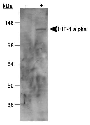 HIF1A / HIF1 Alpha Antibody (aa432-528, clone H1alpha67, DY650)
