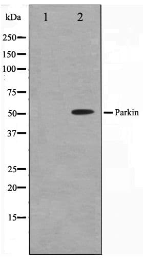 PARK2 / Parkin 2 Antibody