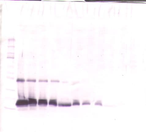IHC-plus™ Polyclonal Rabbit anti-Human TIMP1 Antibody (aa24-207, IHC, WB)