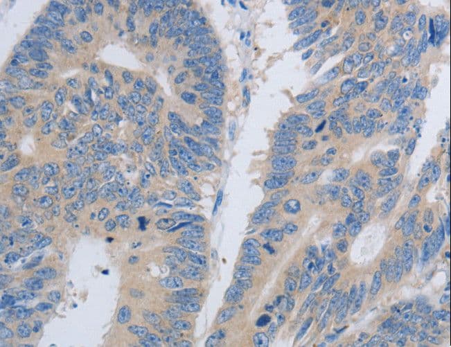 PAWR / PAR4 Antibody