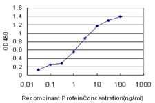 IHC-plus™ PKG / PRKG1 Antibody (clone 2B3)