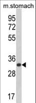 CDIPT Antibody (aa99-125)