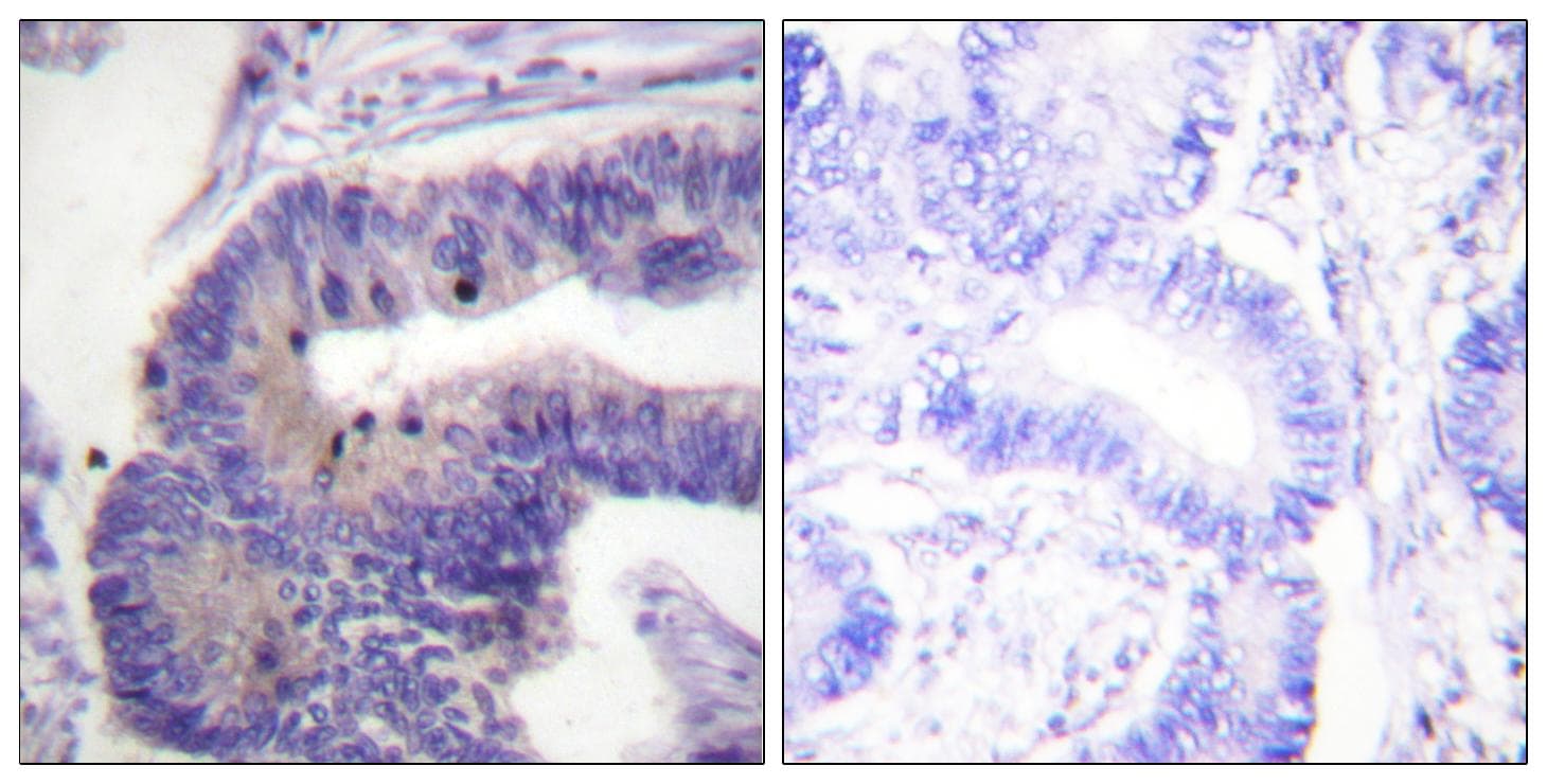 PDE4D Antibody (p190/53)