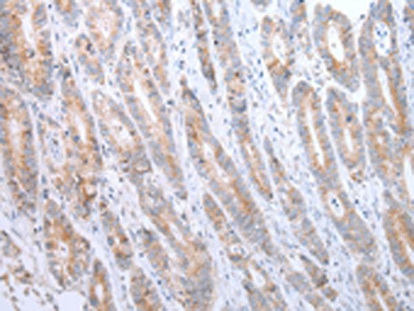 Polyclonal Rabbit anti-Human ATG16L1 / ATG16L Antibody (IHC, WB)