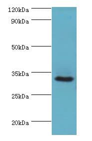 Polyclonal Rabbit anti-Human CA8 / Carbonic Anhydrase VIII Antibody (aa1-290, IHC, WB)