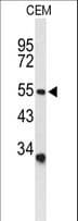 ASIC1 / ACCN2 Antibody (aa500-526)