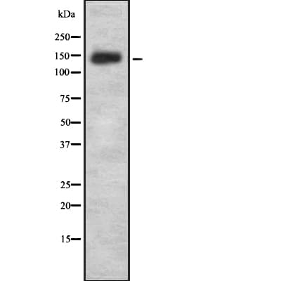Polyclonal Rabbit anti-Human SYNGAP Antibody (WB)