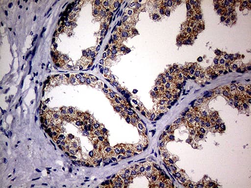 MAK Antibody (aa291-623, clone OTI1G2)