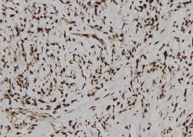 TARBP2 / TRBP2 Antibody