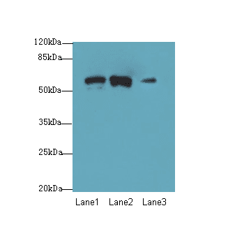 SPTLC3 / C20orf38 Antibody